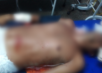 Irmão de Zé Roberto é baleado com mais de cinco tiros em Manaus