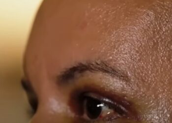 Mulher que teve rosto desfigurado com 61 socos manda recado para agressor: ‘Sobrevivi’