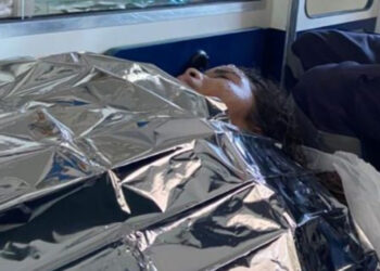 Jovem vítima no incêndio em fábrica no Distrito está internada