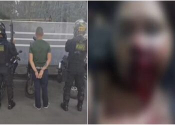 Homem é preso após desfigurar rosto de companheira enquanto dormia