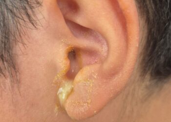 Servidor do TJAM é suspeito de perfurar tímpano de menino de 8 anos em Manaus