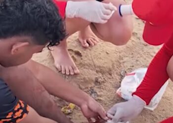 Seis banhistas ficam feridos em novo ataque de piranhas em balneário em Manacapuru