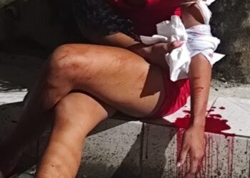 Homem é detido por populares suspeito de esfaquear companheira na Chapada